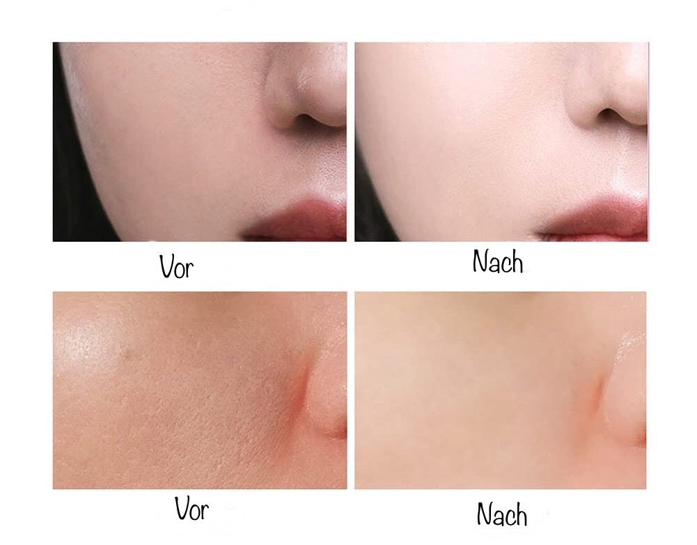 (1+1 GRATIS) Skin Care Gel™- Facial Primer met onzichtbare poriën